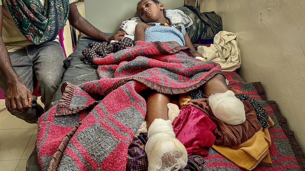 Iyerusalem, 10, needed both legs amputated after heavy shelling in Qarsole, Tigray, that also killed her brother